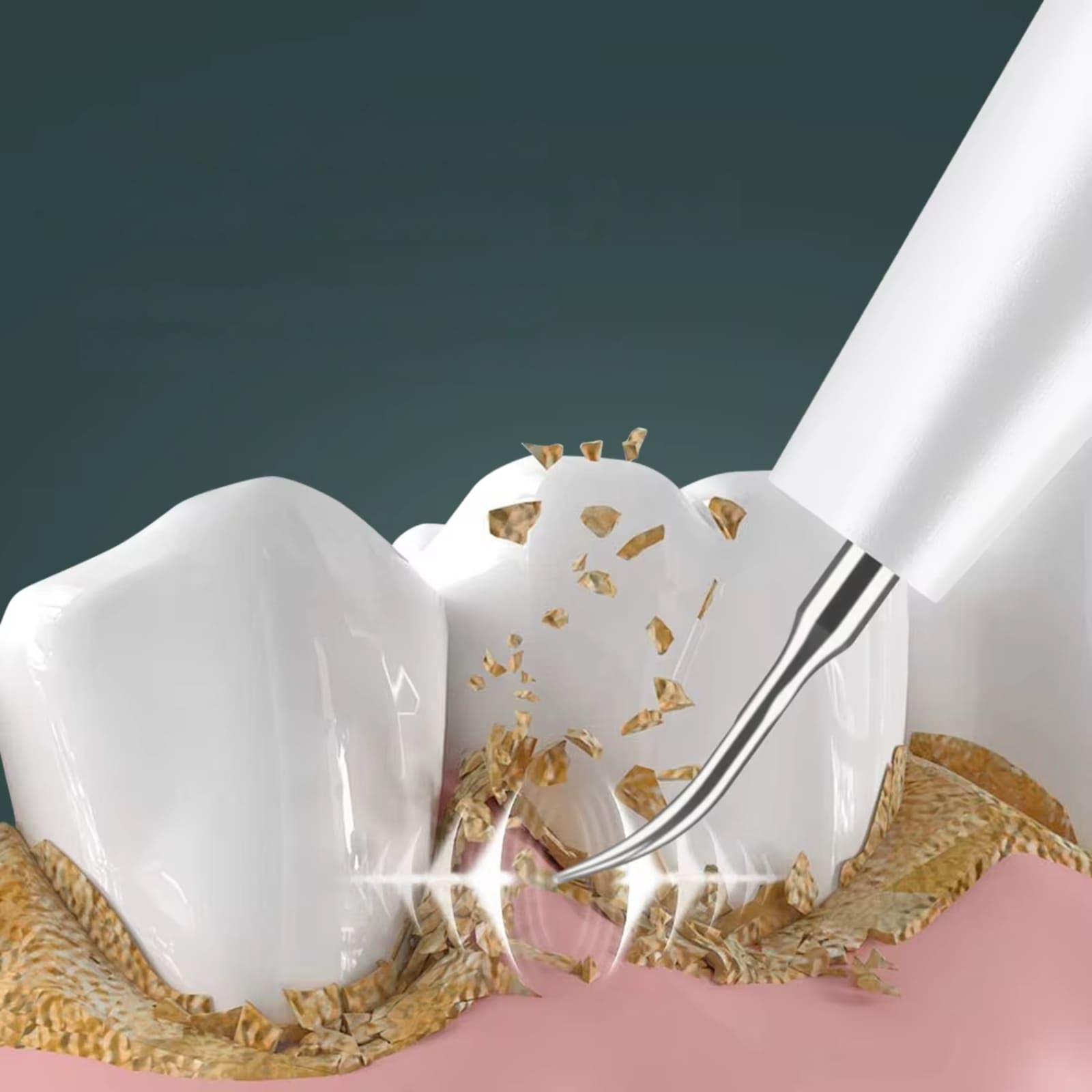 Electric Tooth Polishers & Dental Cleaning Tools